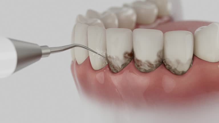 Reliable Root Canal Treatment contractor in Chisago County County, MN by Dentist Open Now